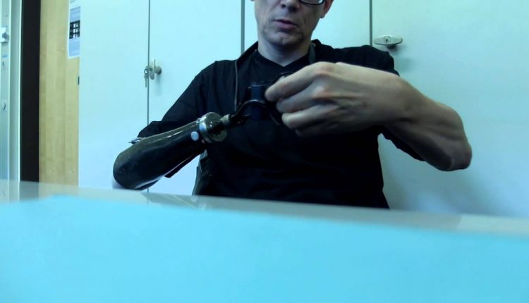 Using consumer photo camera with prosthetic arm - hook