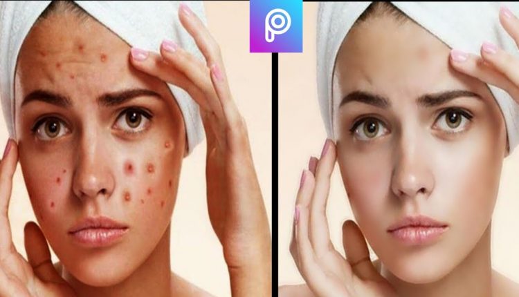 How to remove pimples/acne with PICSART PHOTO STUDIO