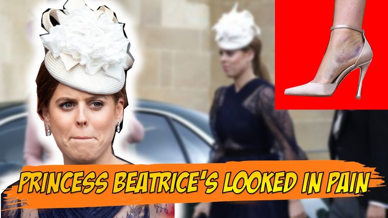 Princess Beatrice's painful injury revealed in new wedding photos - Ann Breaking news
